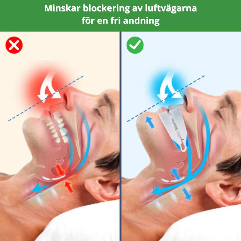 Snarkskena - Snarkskena – For Lugnare og Ostørda Nætter